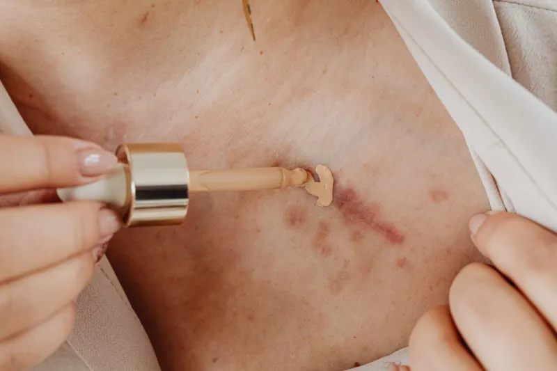 Taches, marques et hyperpigmentation : le guide maquillage pour retrouver un teint unifié et lumineux